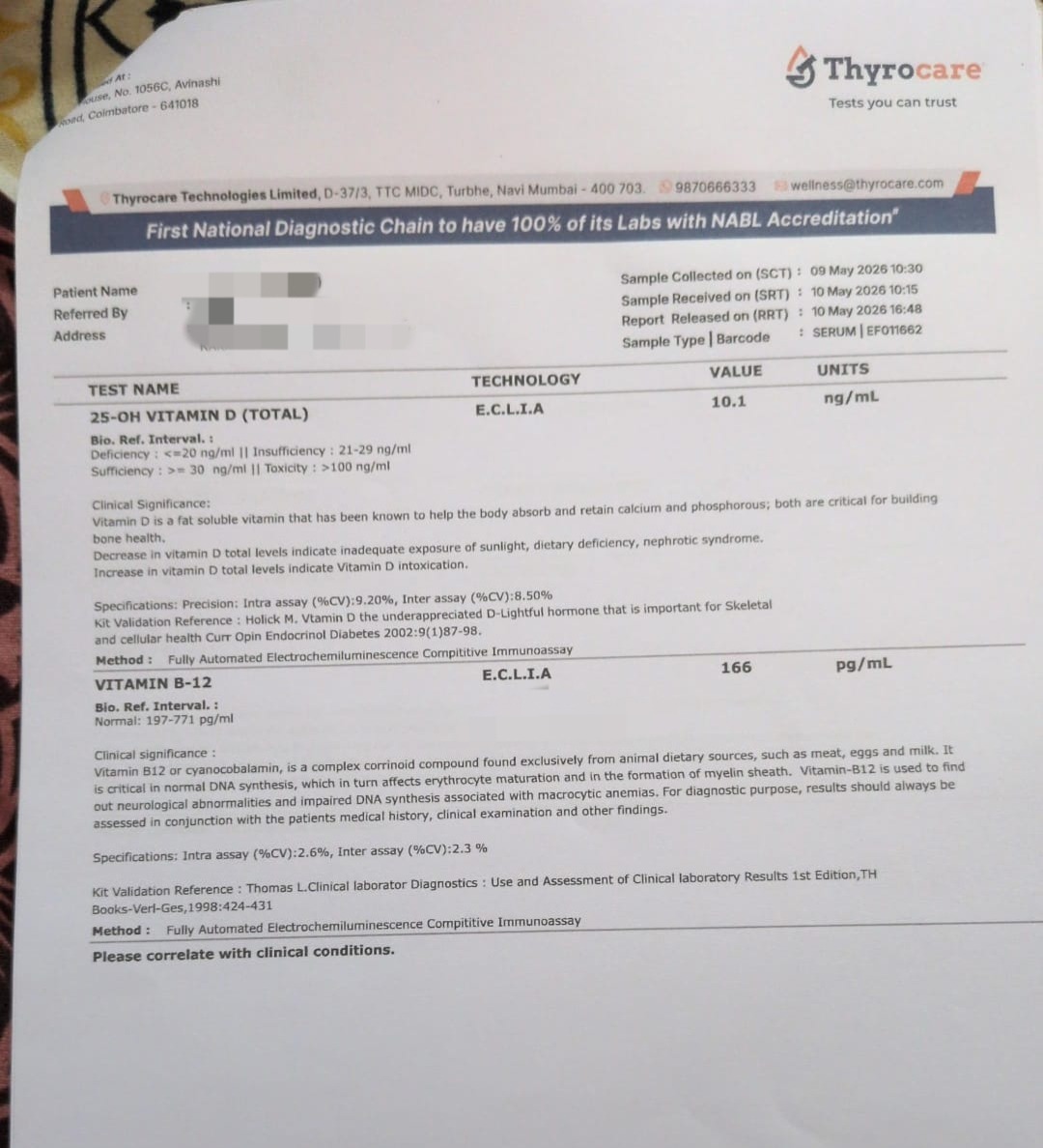 Thyrocare report showing 25-OH vitamin D at 10.1 ng/mL, in the deficiency range, and vitamin B12 at 166 pg/mL, below the reference range of 197 to 771